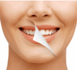 הלבנת שיניים: איך עושים זאת בקלות ובמהירות?-תמונה